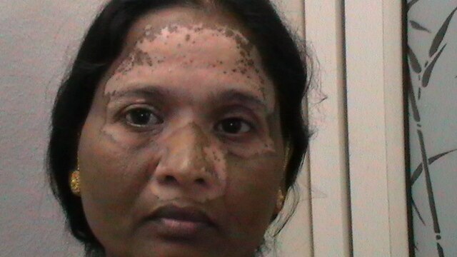 Dr. Nambiar's Advanc