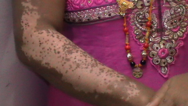 Dr. Nambiar's Advanc