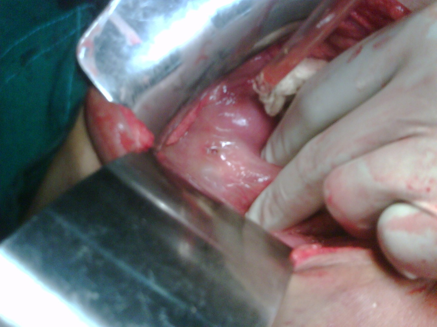 Pawar Surgical Hospi