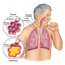 Rathi Chest Clinic