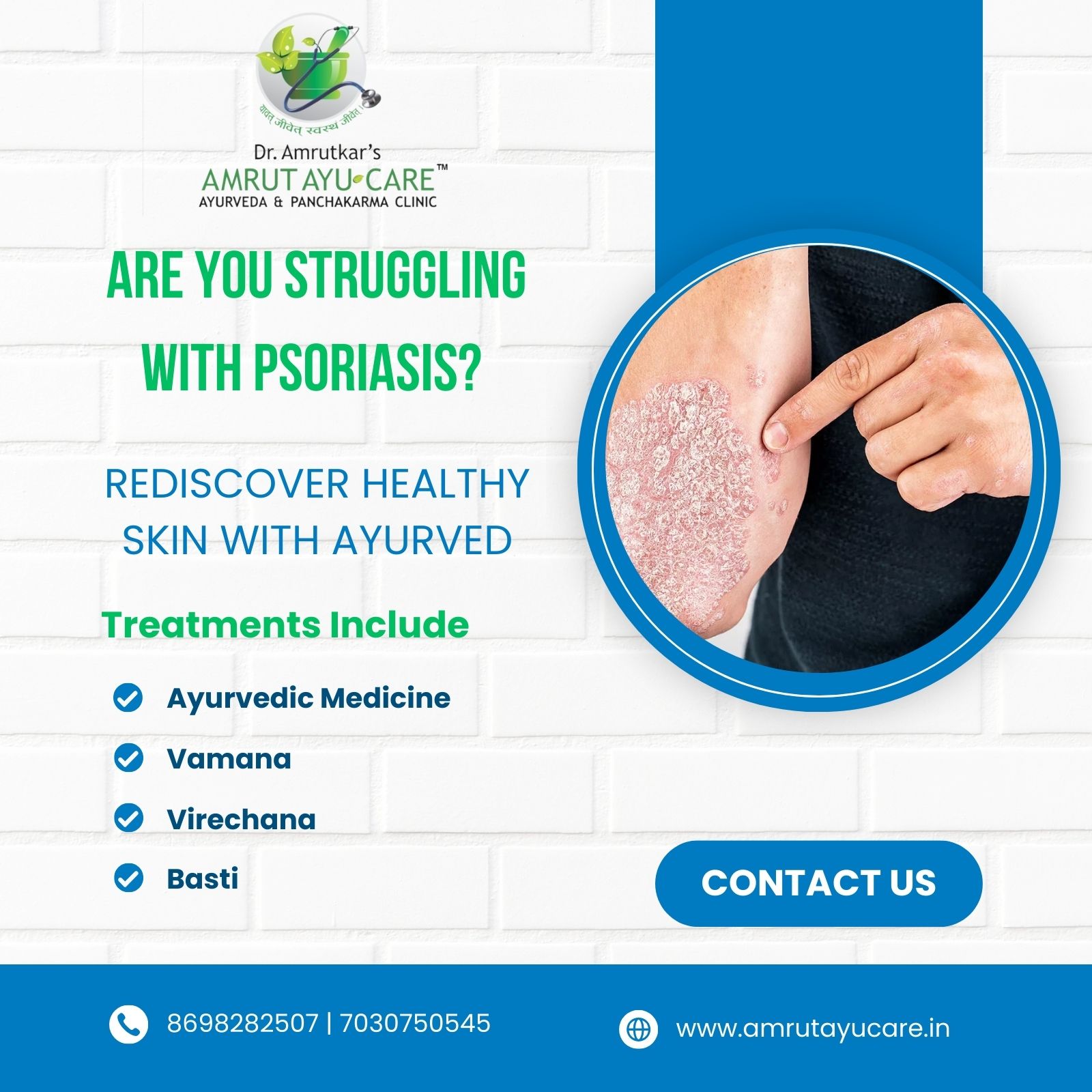 Psoriasis Ayurvedic 
