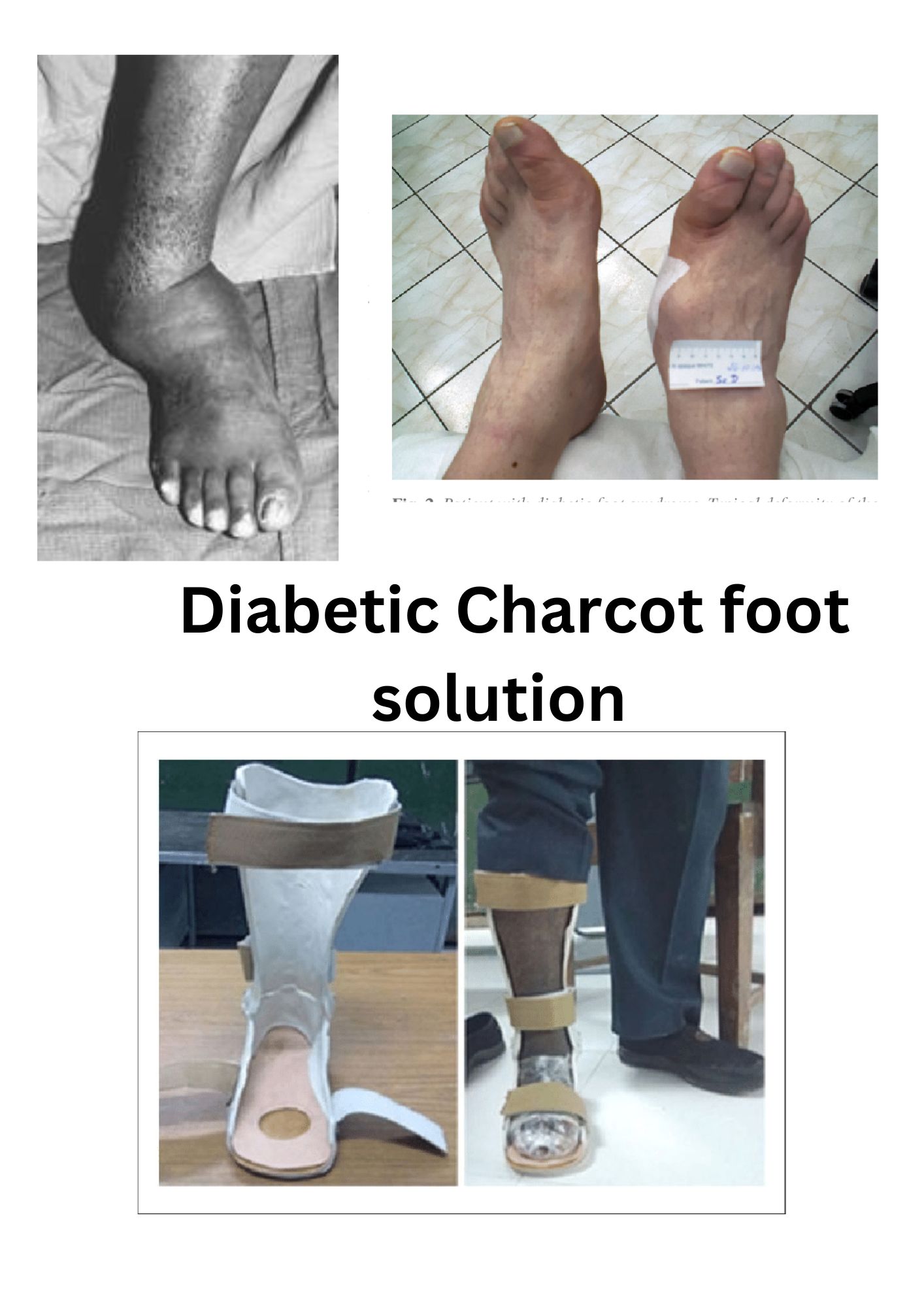 Diabetic.jpg