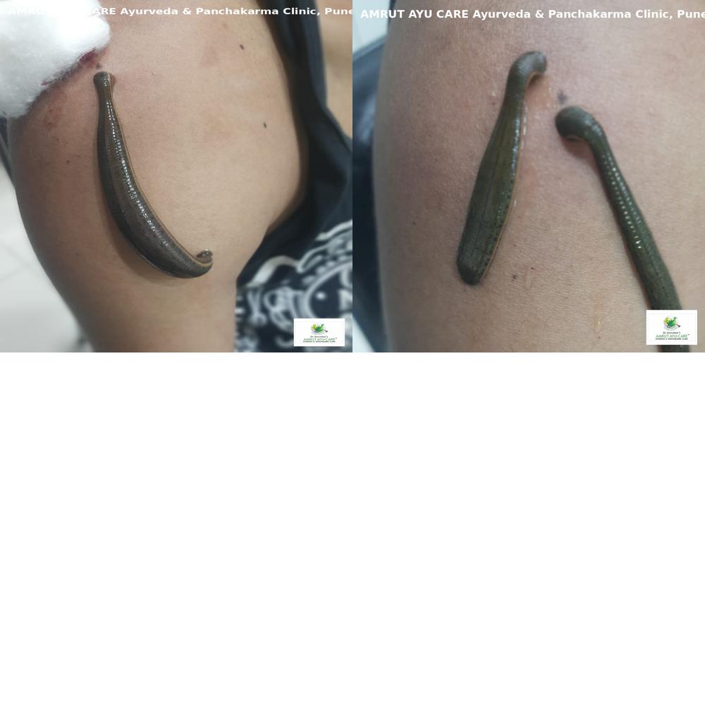 leech_collage_3.jpg