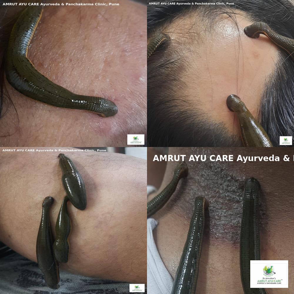 leech_collage_2.jpg
