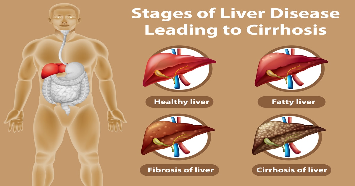 Liver Treatment.jpg