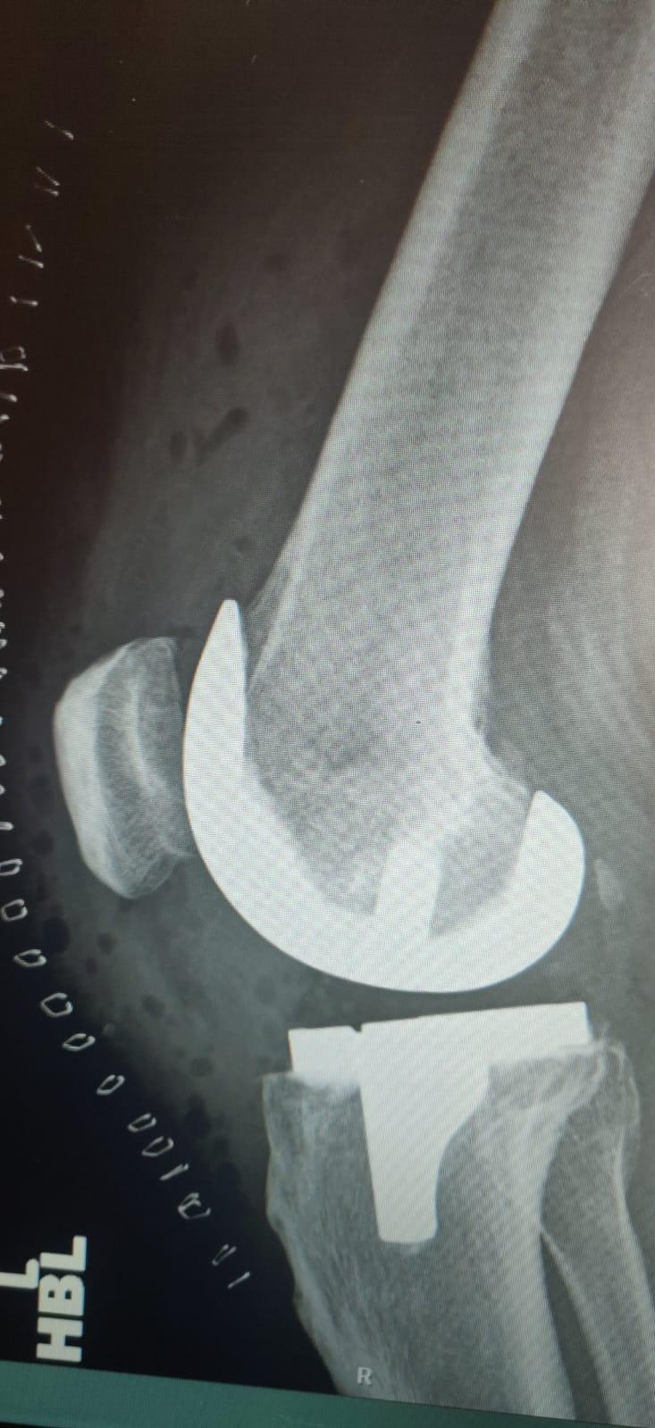 Knee 1.jpeg
