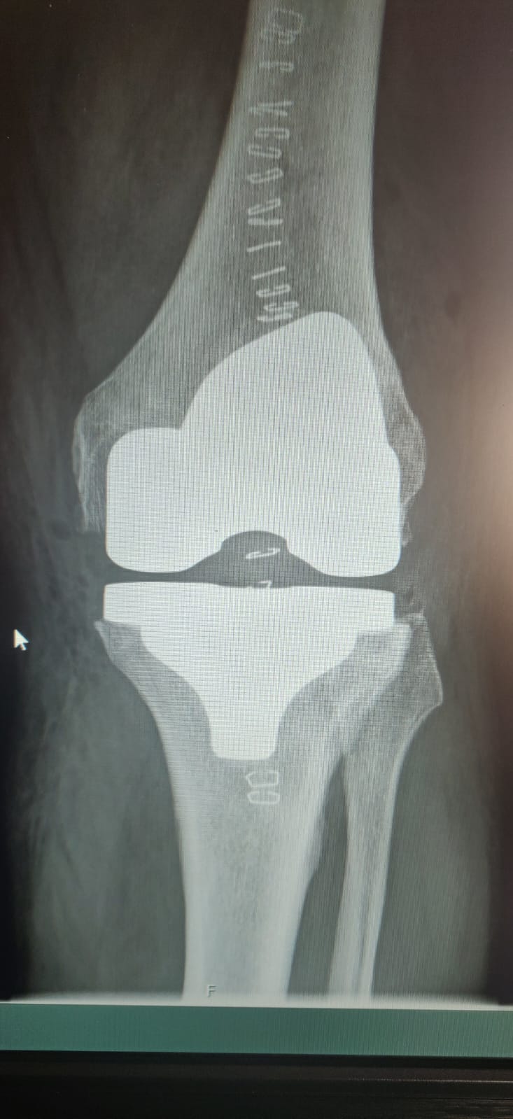 Knee 2.jpeg