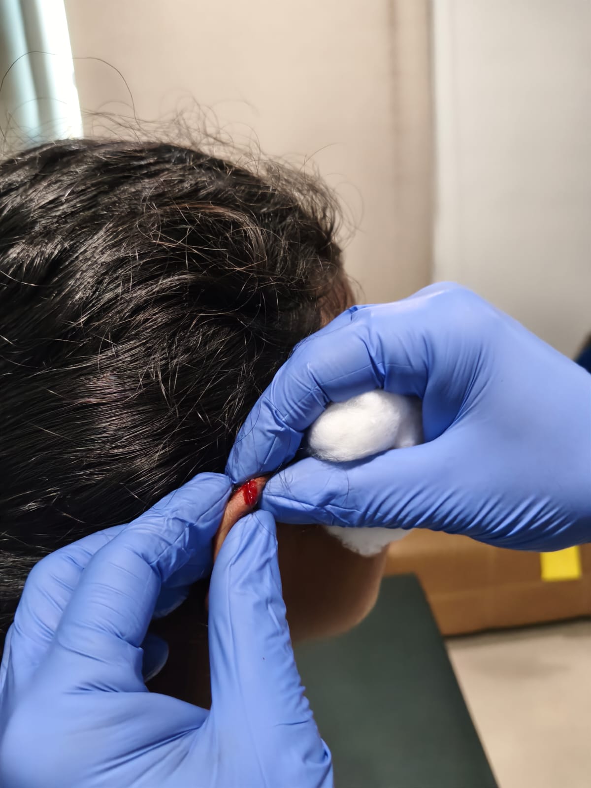Bloodletting_therapy