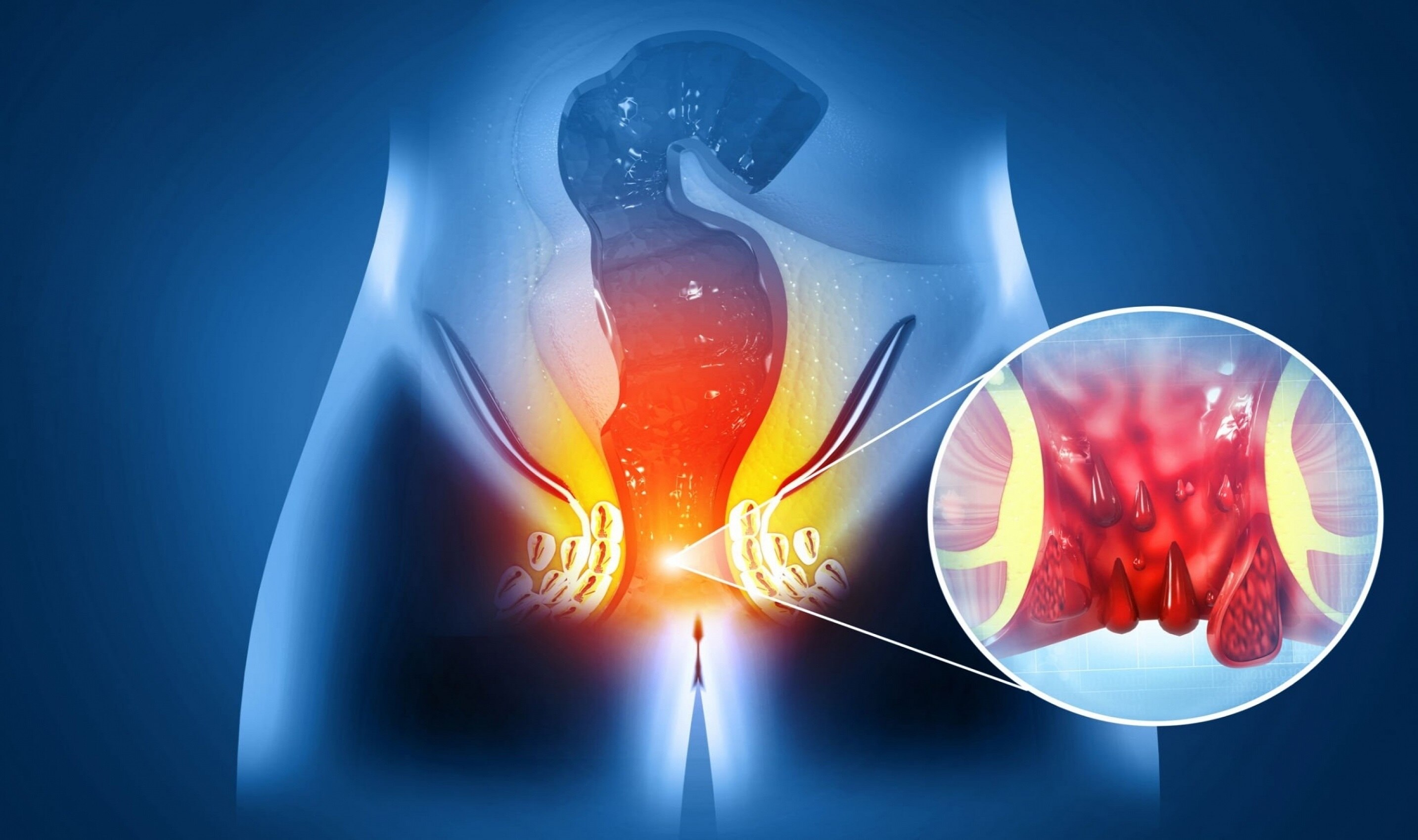 treatment-fistula.jp