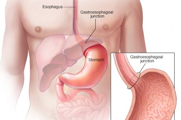 GI-Cancer-1.jpg