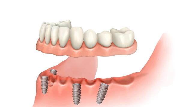 Denteus : The Specialist Hub