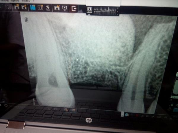 Dr.Agarwal Dental Cl