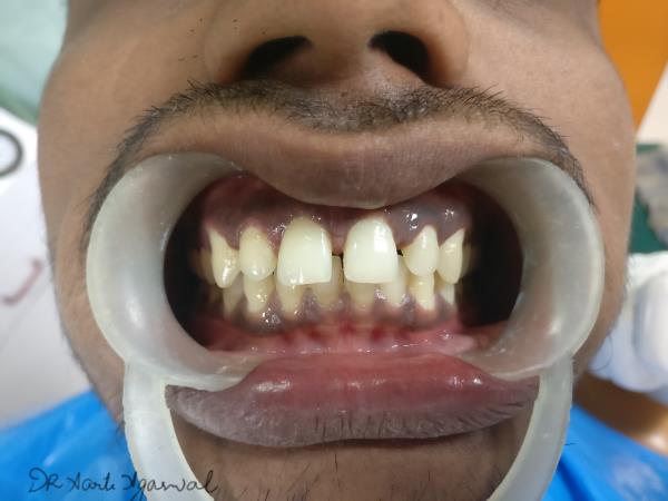Dr.Agarwal Dental Cl