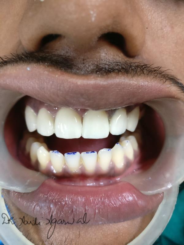 Dr.Agarwal Dental Cl