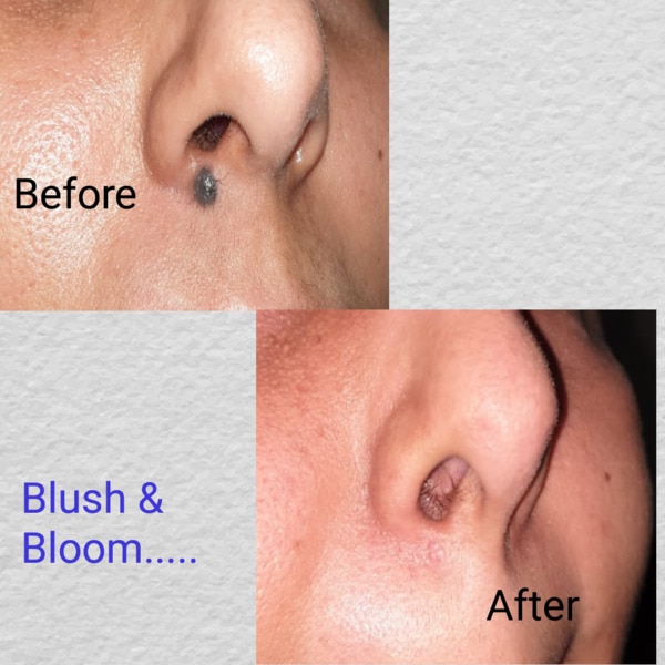 Blush & Bloom Clinic 8000512044 gallery