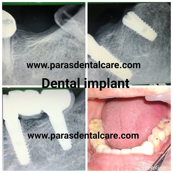 Paras Dental Care gallery