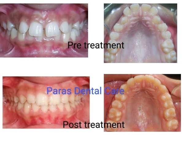 Paras Dental Care gallery