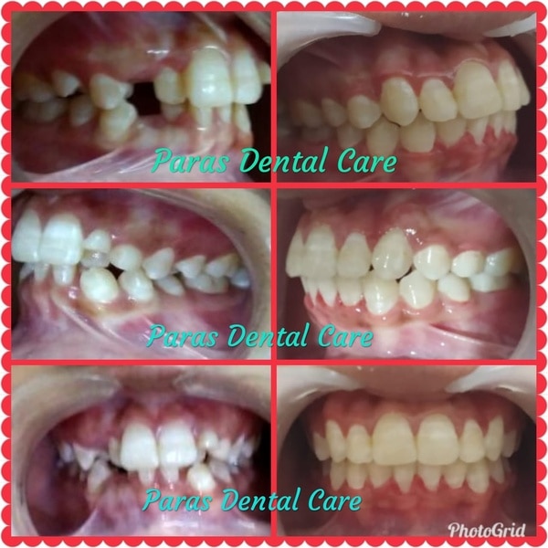 Paras Dental Care gallery