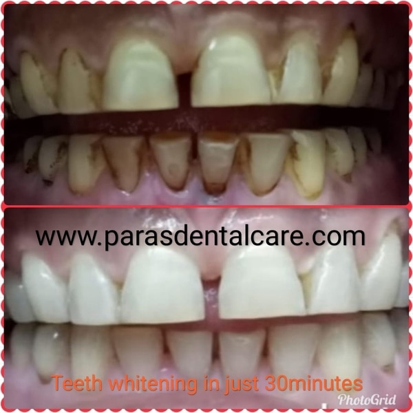 Paras Dental Care gallery