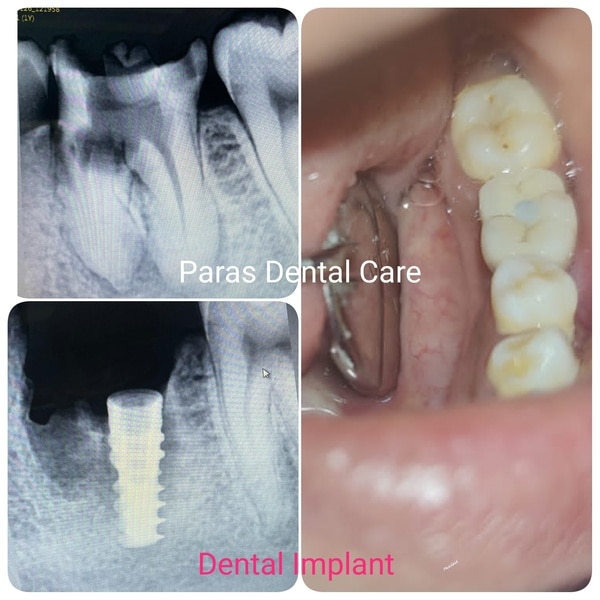 Paras Dental Care gallery