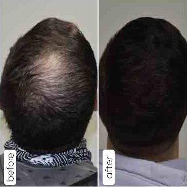 Dr Pallavi Chaudhari gallery