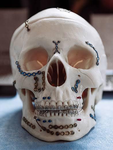 Dent-O-Facial Multi-specialty Dental Clinic. gallery