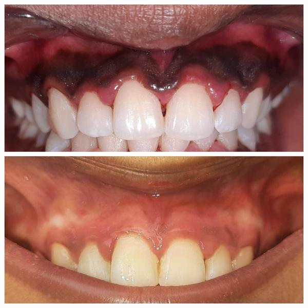 Dent-O-Facial Multi-specialty Dental Clinic. gallery