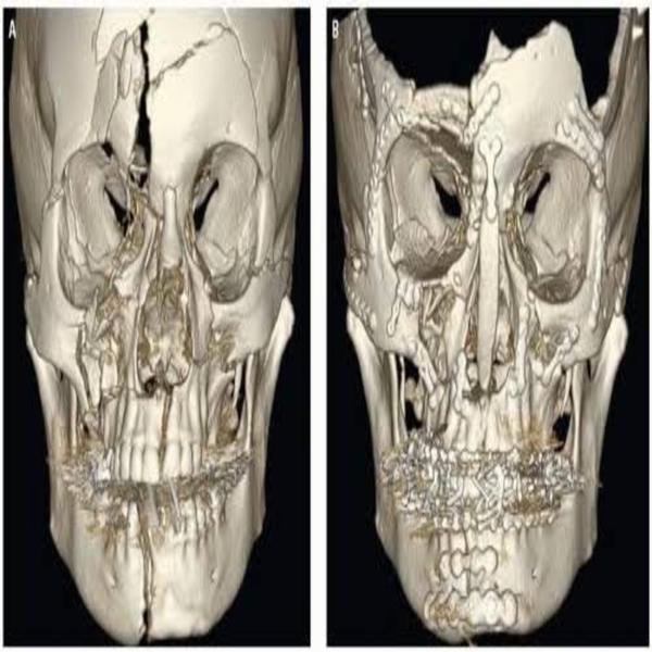 Dent-O-Facial Multi-specialty Dental Clinic. gallery
