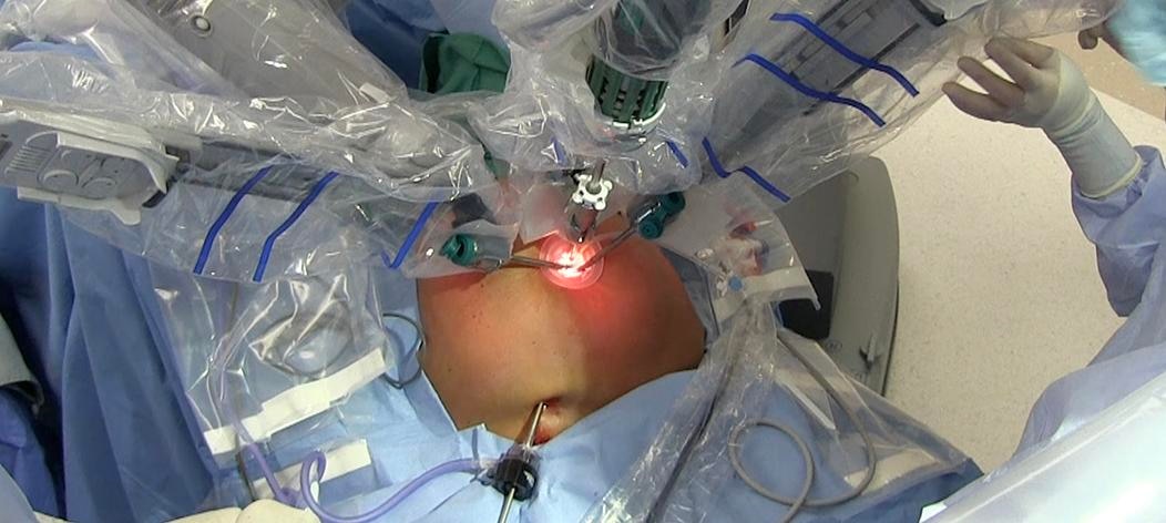Robotic Bariatric Surgery, Robotic Cancer Surgery gallery