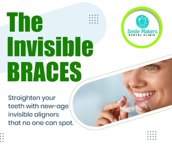 Smile Makers Dental Clinic,Pimple Saudagar,PCMC gallery