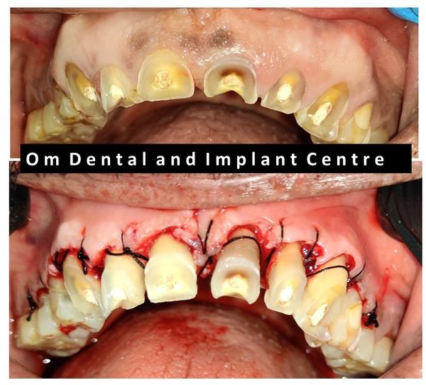 Om Dental and Implant Centre gallery
