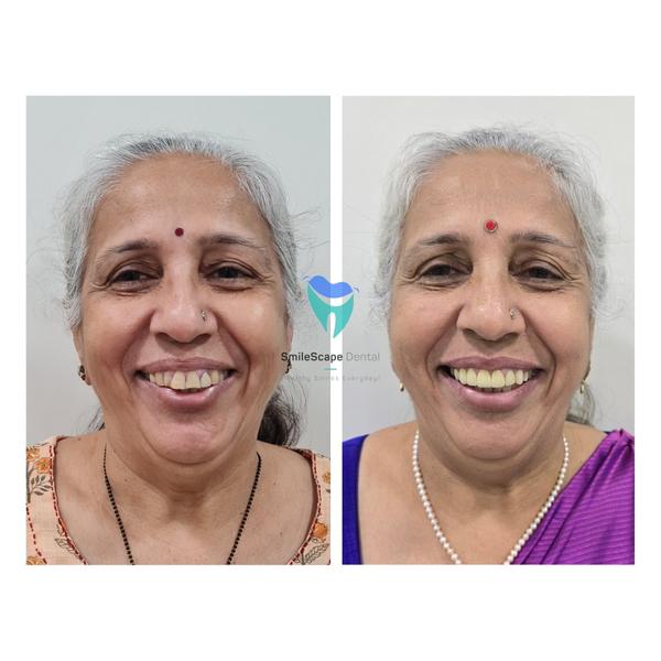 SmileScape Dental gallery
