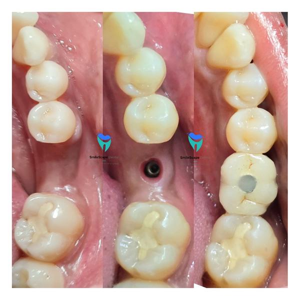 SmileScape Dental gallery