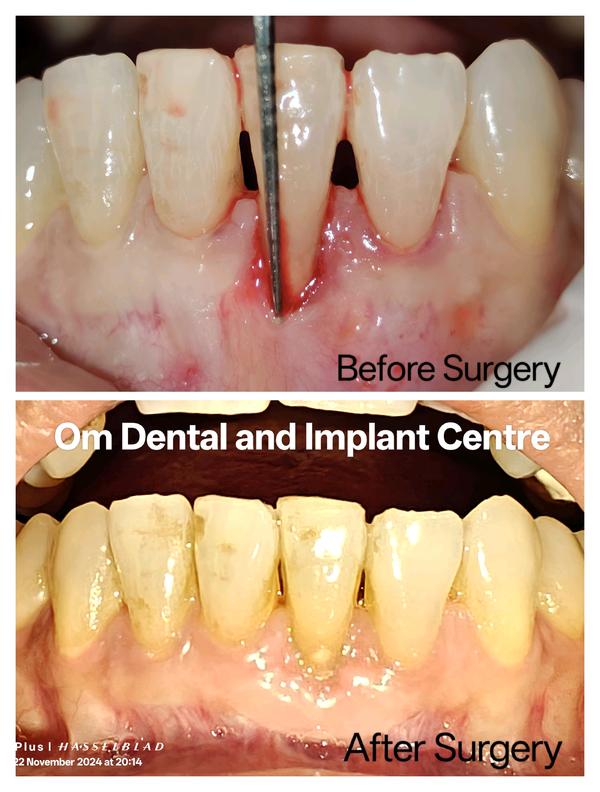 Om Dental and Implant Centre gallery