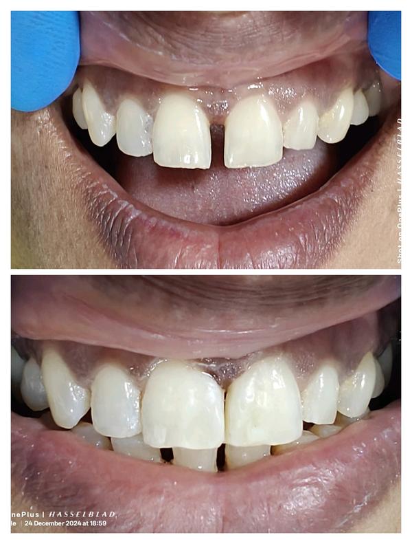 Om Dental and Implant Centre gallery