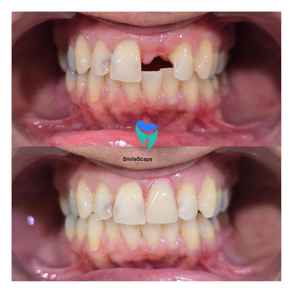 SmileScape Dental gallery