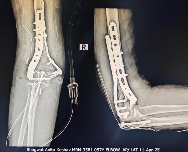 Soham Orthopaedic and General health clinic gallery