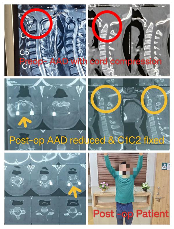 Dr Kakani Neuro and Spine Care Centre gallery