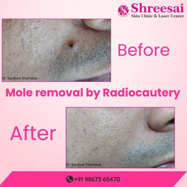 Shreesai Skin Clinic & Laser Center gallery