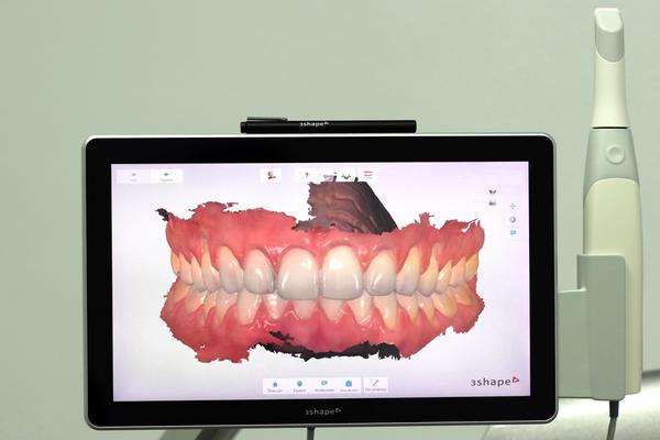 ProFace-ProDent gallery