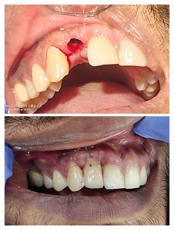 Om Dental and Implant Centre gallery