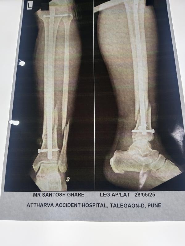 ATTHARVA HOSPITAL gallery