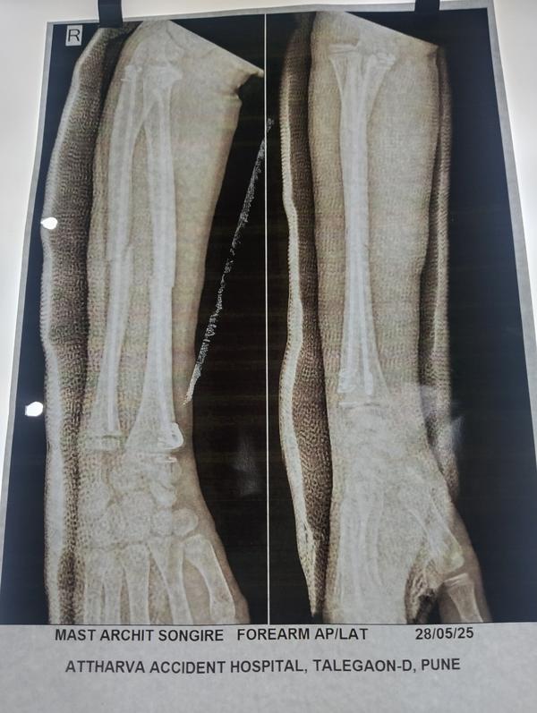 ATTHARVA HOSPITAL gallery