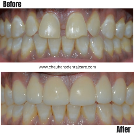 Chauhan's Dental Care gallery