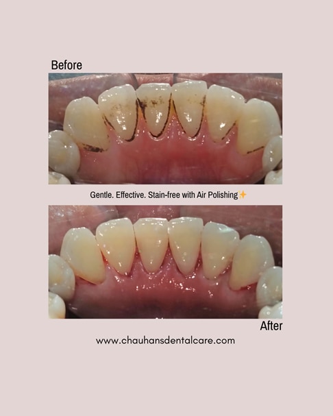 Chauhan's Dental Care gallery