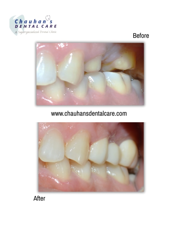 Chauhan's Dental Care gallery