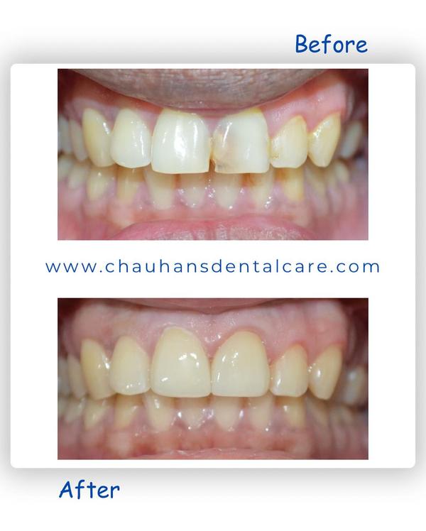 Chauhan's Dental Care gallery