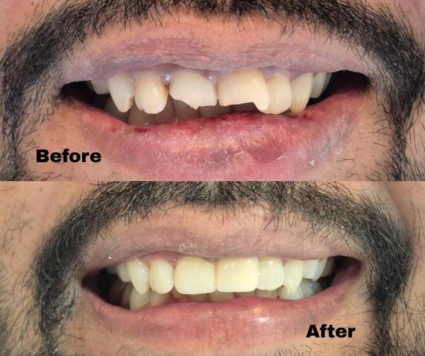 Chauhan's Dental Care gallery