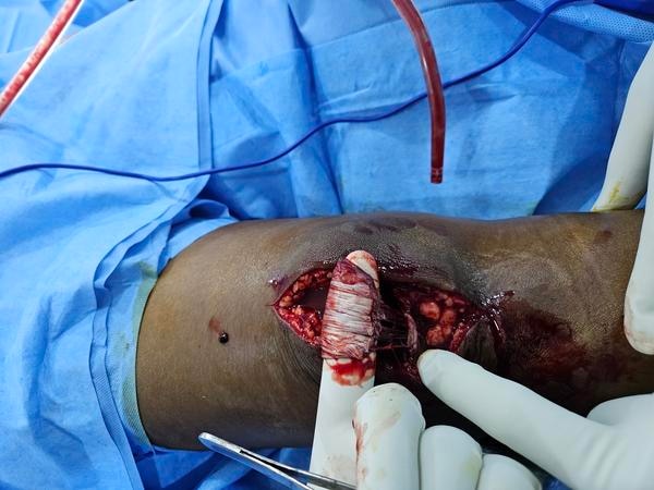 S A Hospital gallery