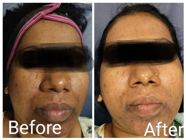 Setu-Best Cosmetology,Sexology Clinic 08042781361 gallery